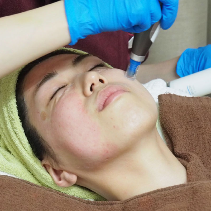 恵比寿の完全サブスク美容皮膚科 | ドゥ・イマージュクリニック恵比寿 画像